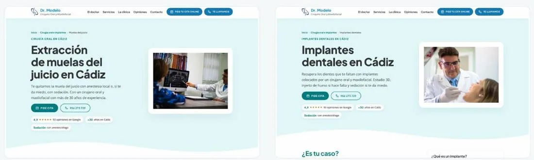 Páginas de muelas del juicio e implantes dentales
